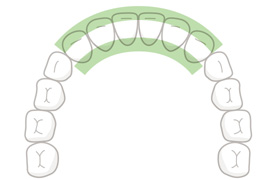 前歯(両側)