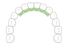 前歯(舌側)