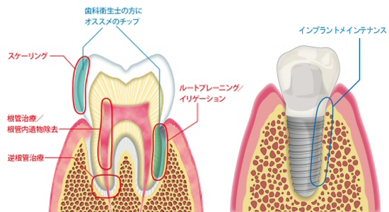 enac_tip_fig.jpg