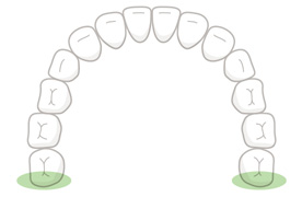 大臼歯(喉側)